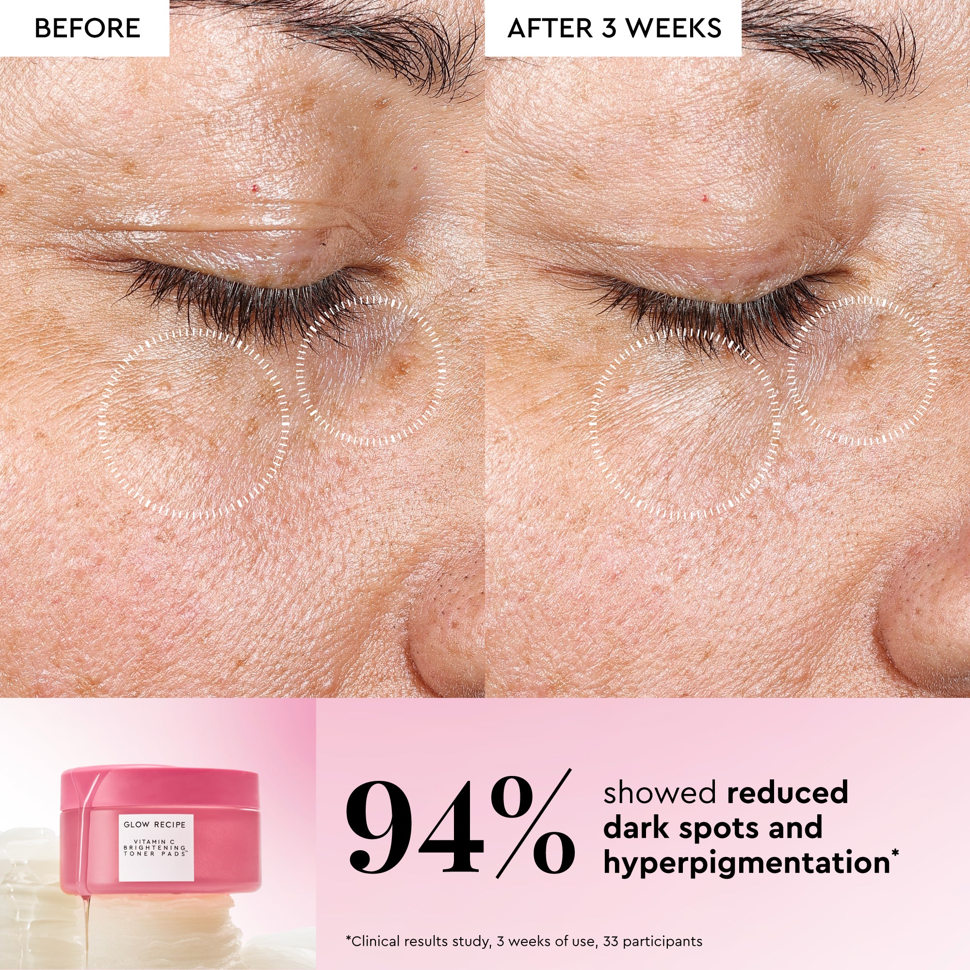 Korean Toner Pad Multi-Masking Kit - Image 10