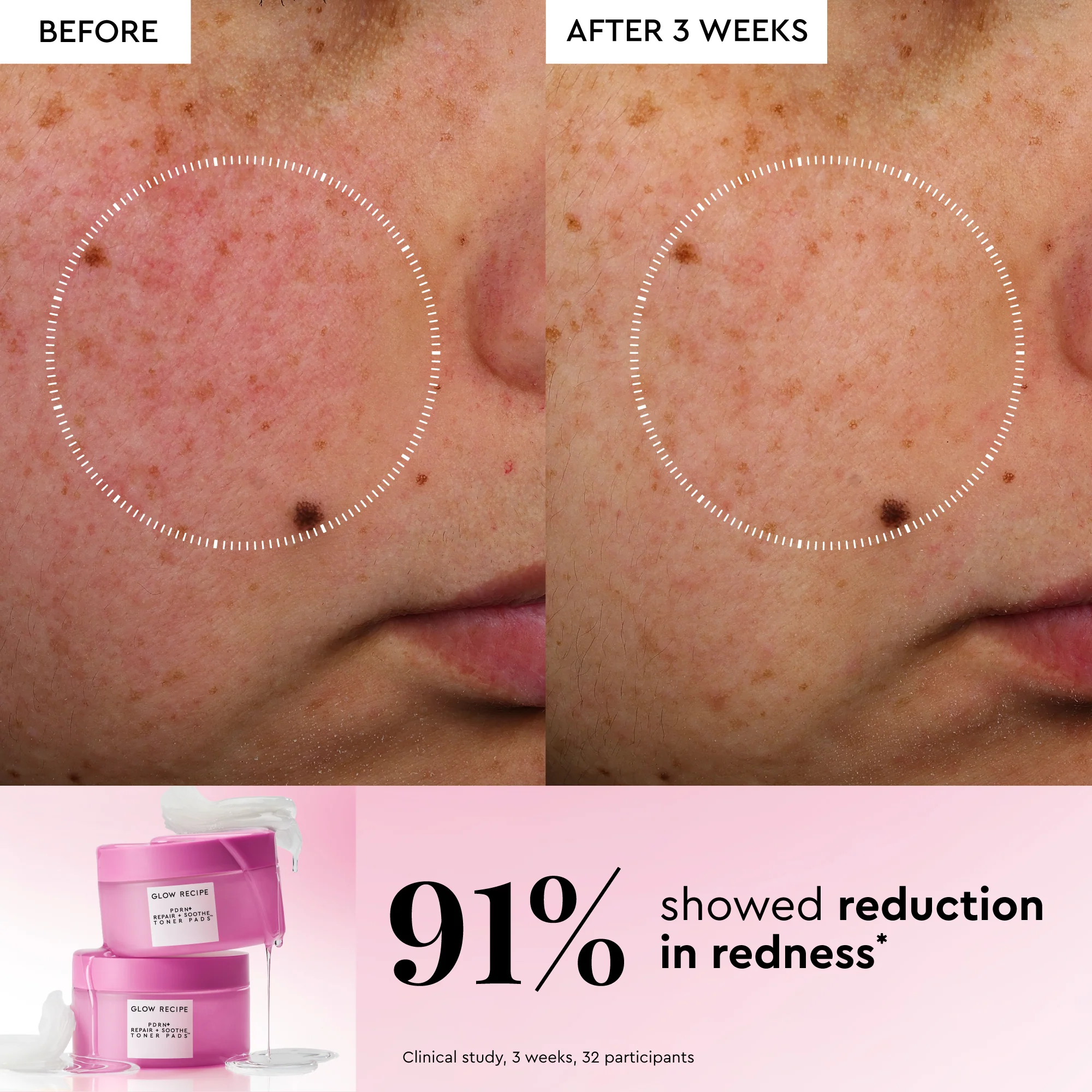 Korean Toner Pad Multi-Masking Kit - Image 6