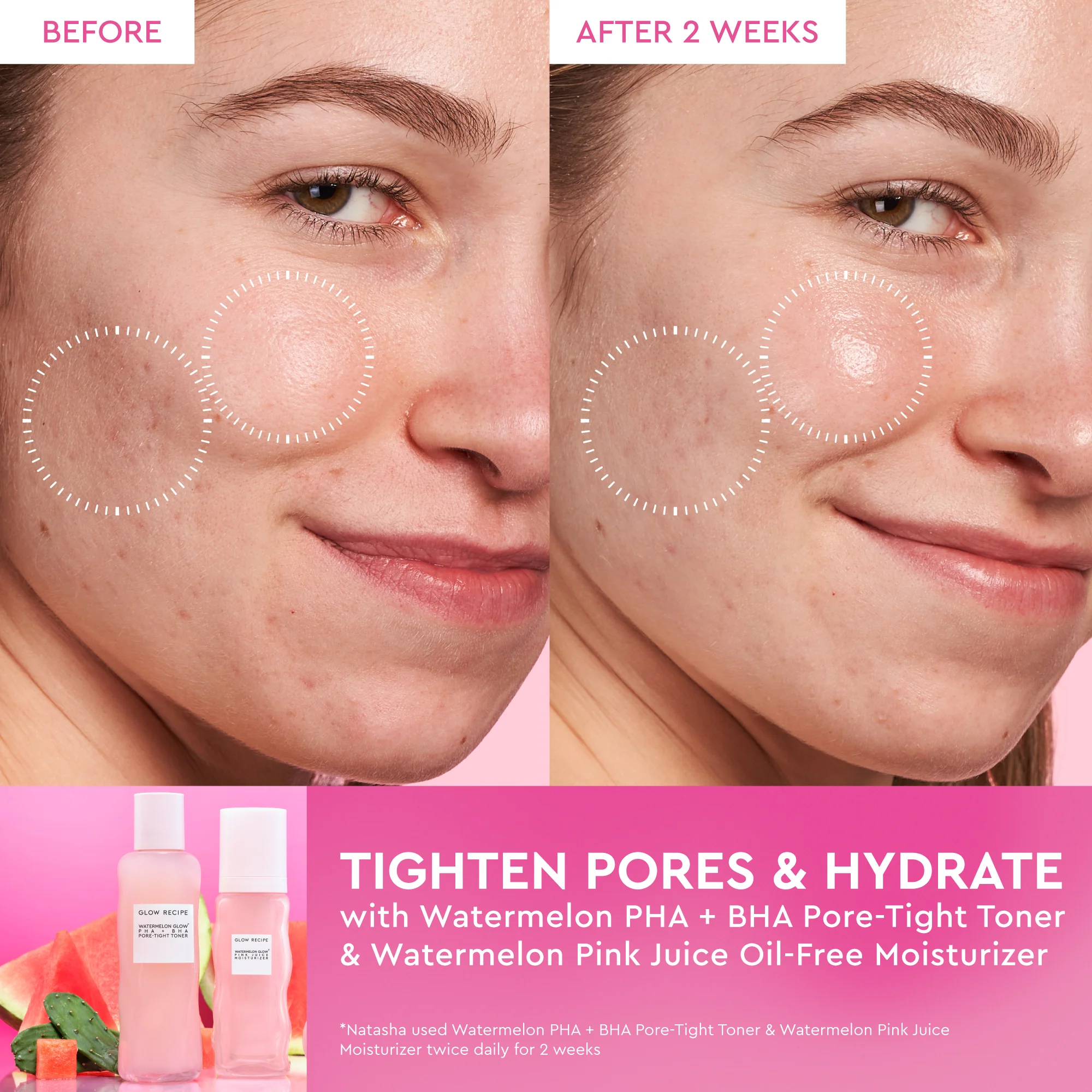 Watermelon Glow PHA+BHA Pore-Tight Toner - Image 16