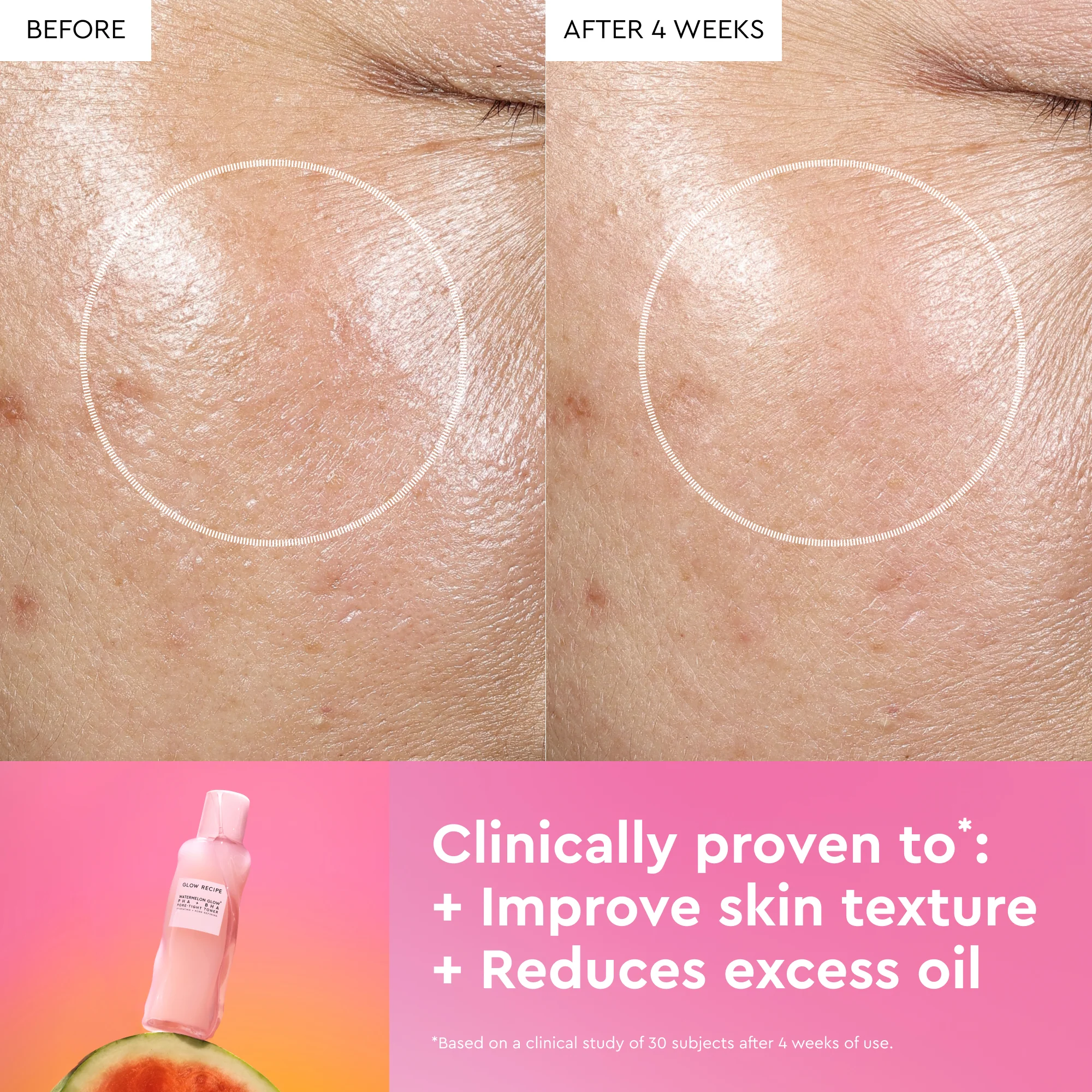 Watermelon Glow PHA+BHA Pore-Tight Toner - Image 7