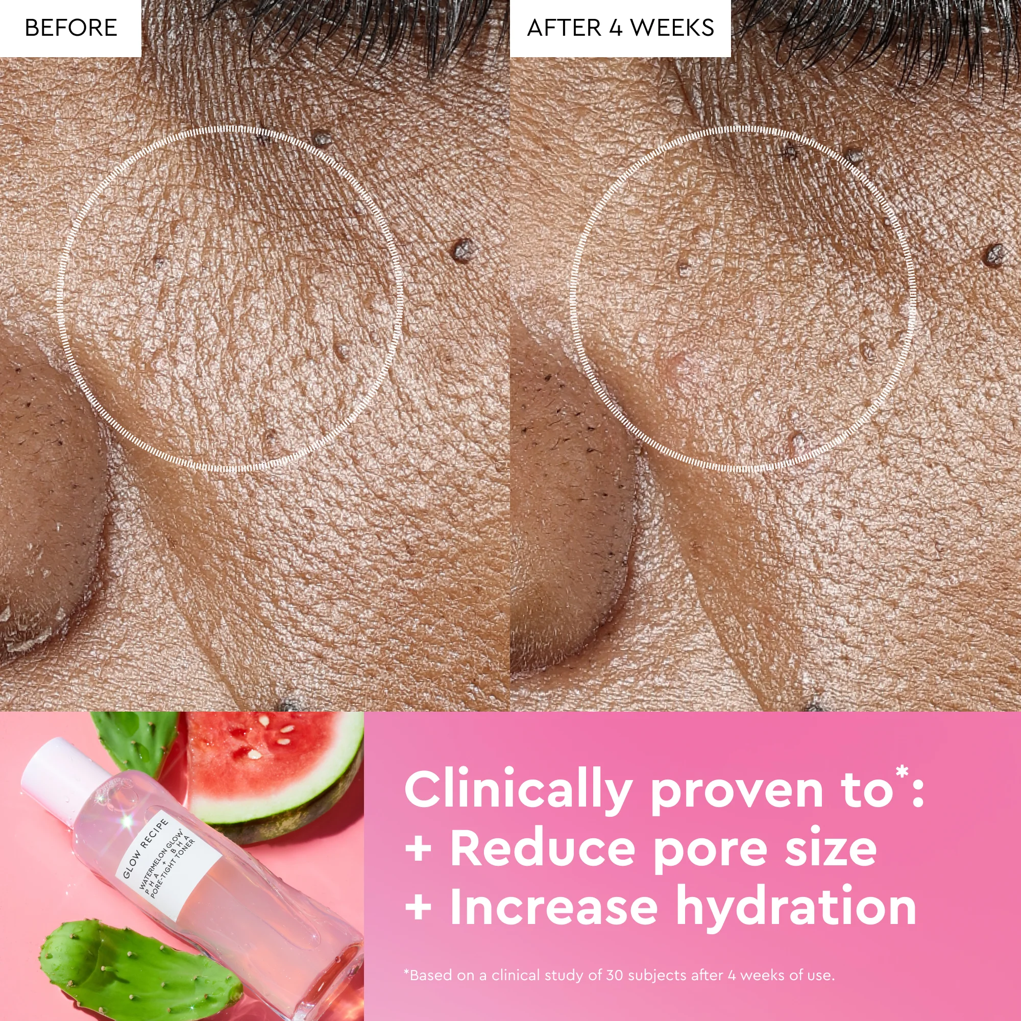 Watermelon Glow PHA+BHA Pore-Tight Toner - Image 9